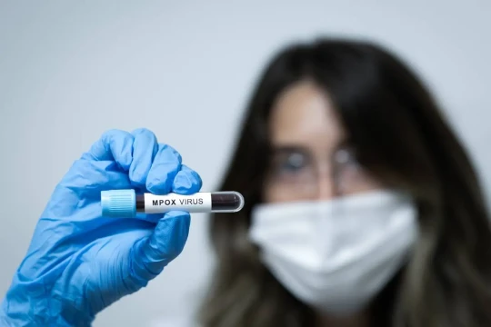 Jordan confirms first mpox case