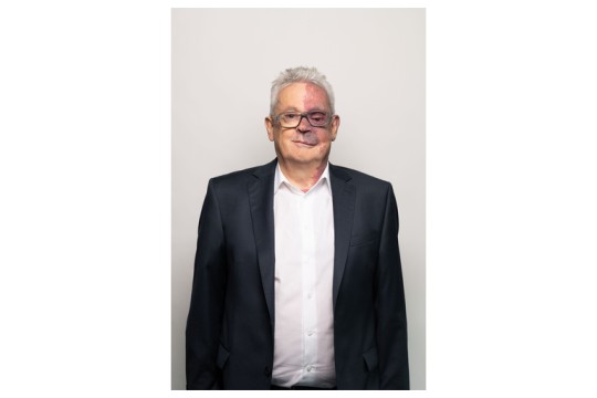 Blood Cancer: AOP Health Announces New Findings in Patients With Polycythemia Vera Published in Medical Journal Leukemia