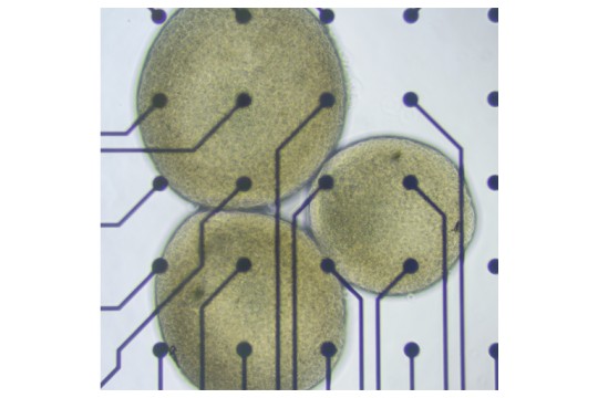 شركة FinalSpark تطلق أول منصة بحث عن بعد باستخدام الخلايا العصبية البشرية للحوسبة الحيوية