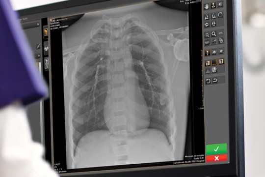 تقدم شركة Carestream برنامج Image Suite MR 10 لتعزيز تجربة التصوير لأنظمة التصوير CR وDR