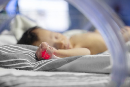 Masimo SET® Pulse Oximetry Performed Accurately on Hospitalized Newborns of All Skin Tones in Largest-Ever Prospective Real-World Study