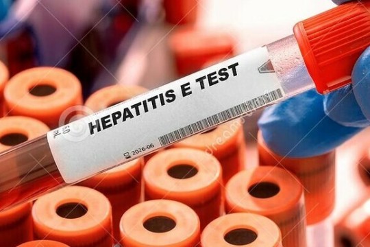 Hepatitis E outbreak declared in Abyei